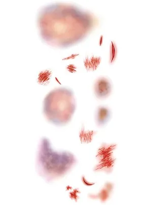 Intensive Care Trauma Temporary Tattoo Wounds