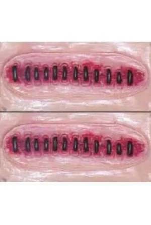 Stitched Up Scars Stick On Adhesive Special FX